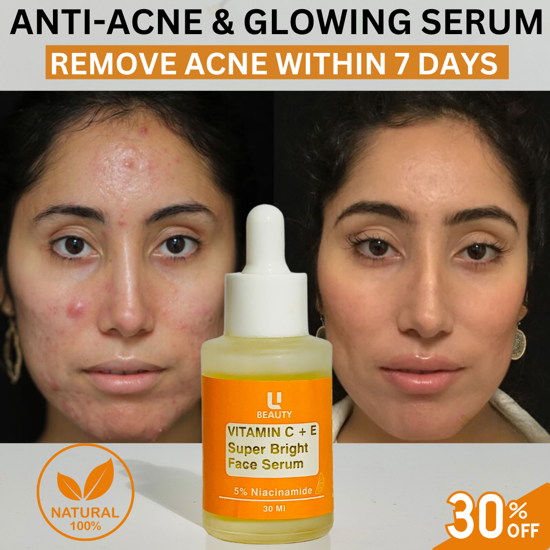 ANTI ACNE SERUM (WITH FREE ACNE FACEWASH )