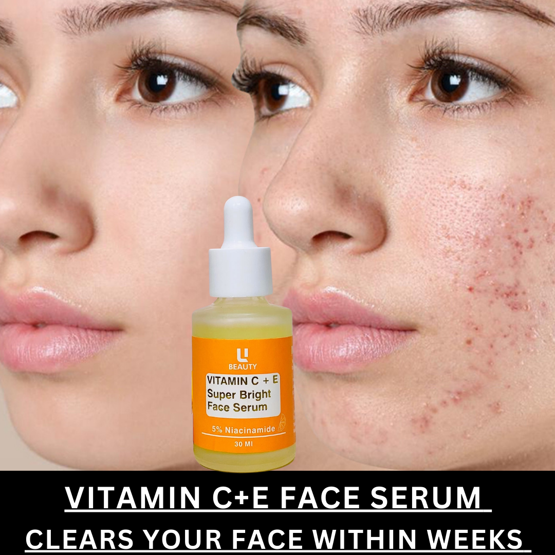 ANTI ACNE SERUM