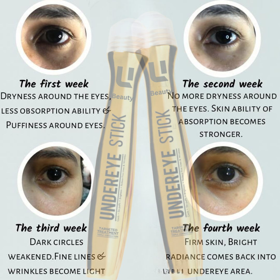 ANTI DARK CIRCLE SERUM (REMOVE DARK CIRCLE IN 7 DAYS )