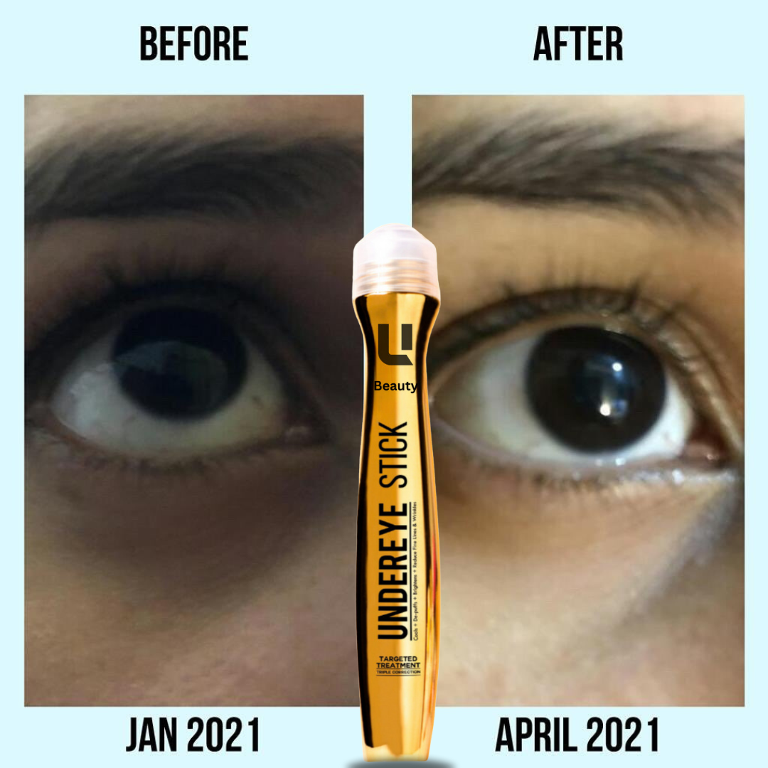 ANTI DARK CIRCLE SERUM (REMOVE DARK CIRCLE IN 7 DAYS )