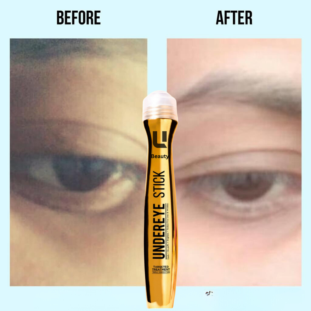 ANTI DARK CIRCLE SERUM (REMOVE DARK CIRCLE IN 7 DAYS )