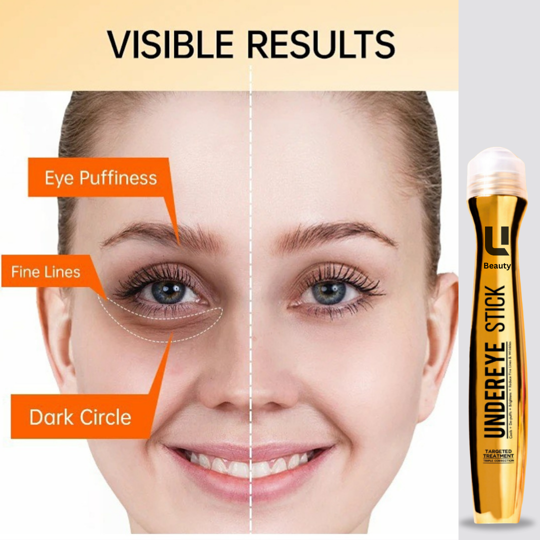 ANTI DARK CIRCLE SERUM (REMOVE DARK CIRCLE IN 7 DAYS )