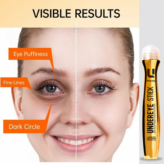 ANTI DARK CIRCLE SERUM (REMOVE DARK CIRCLE IN 7 DAYS )