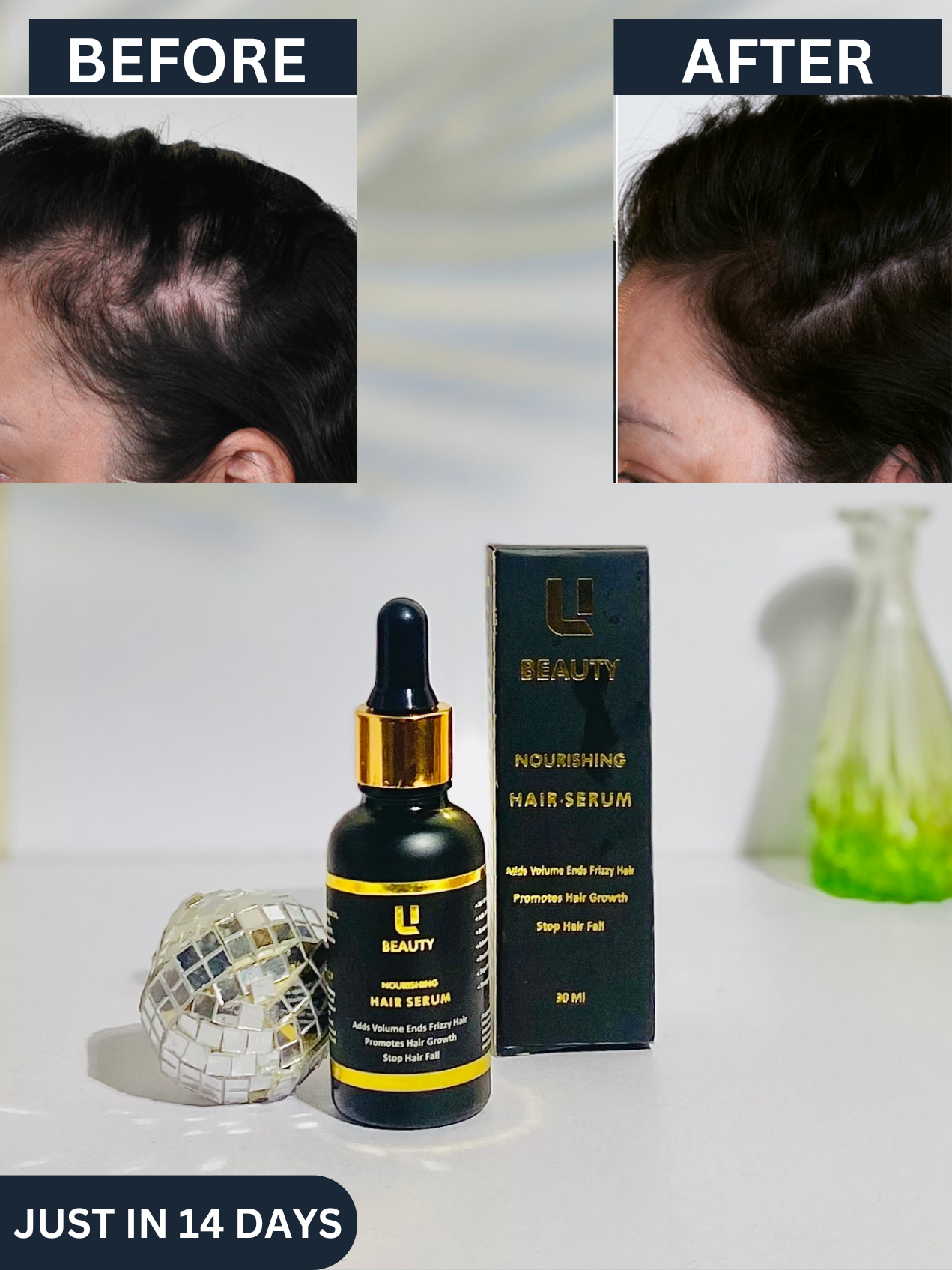HAIR GROWTH SERUM (STOPS HAIRFALL)