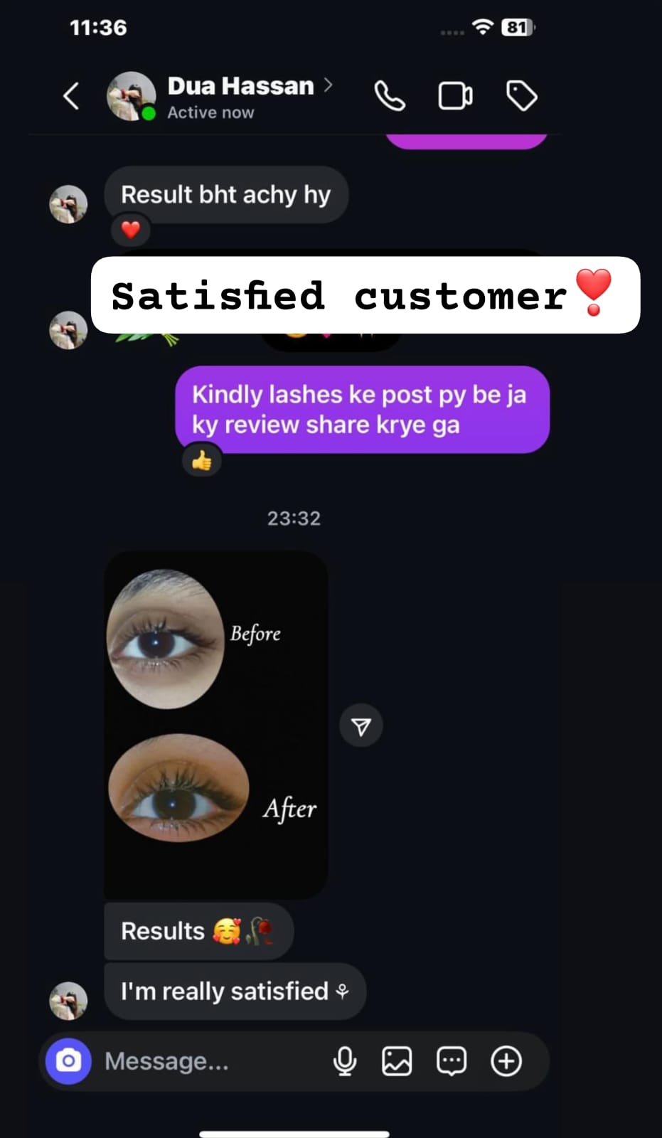 EYELASHES GROWTH SERUM (FREE EYE BROWS GROWTH SERUM)