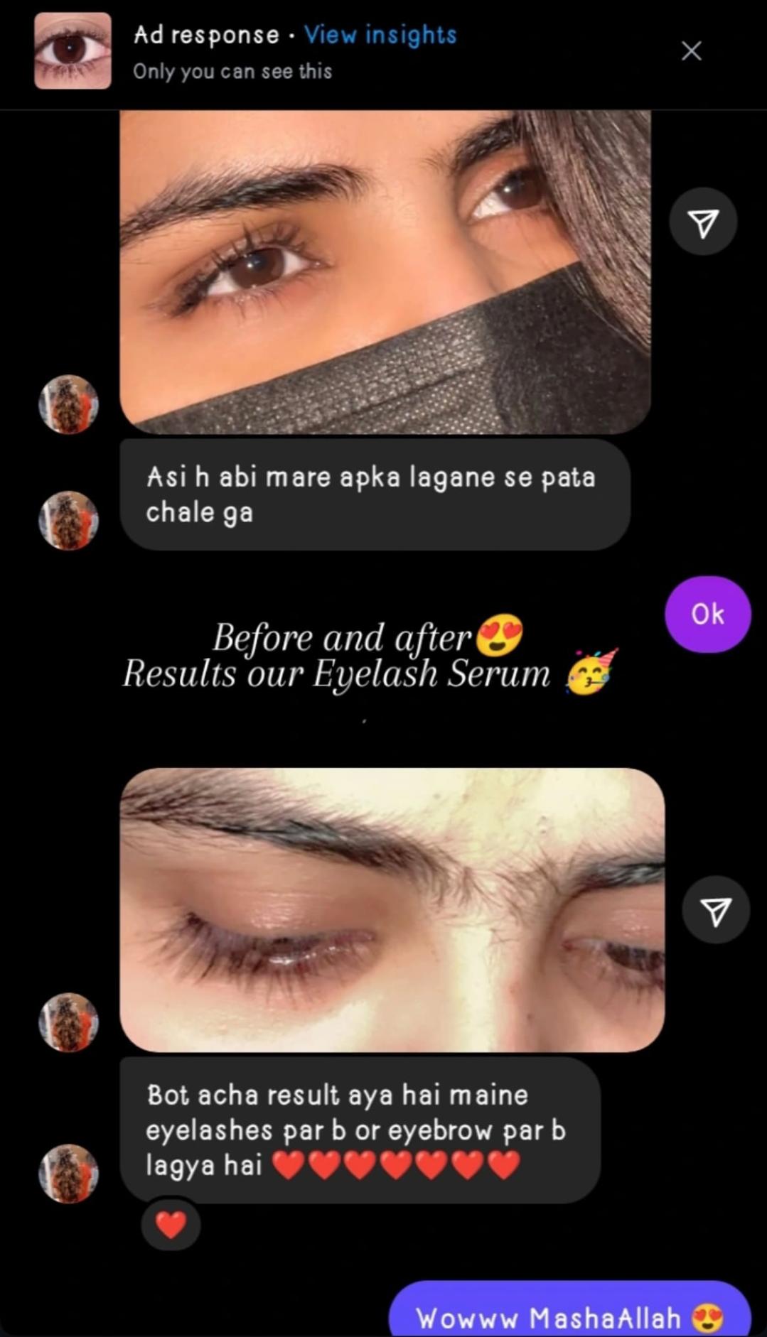 EYELASHES GROWTH SERUM (FREE EYE BROWS GROWTH SERUM)
