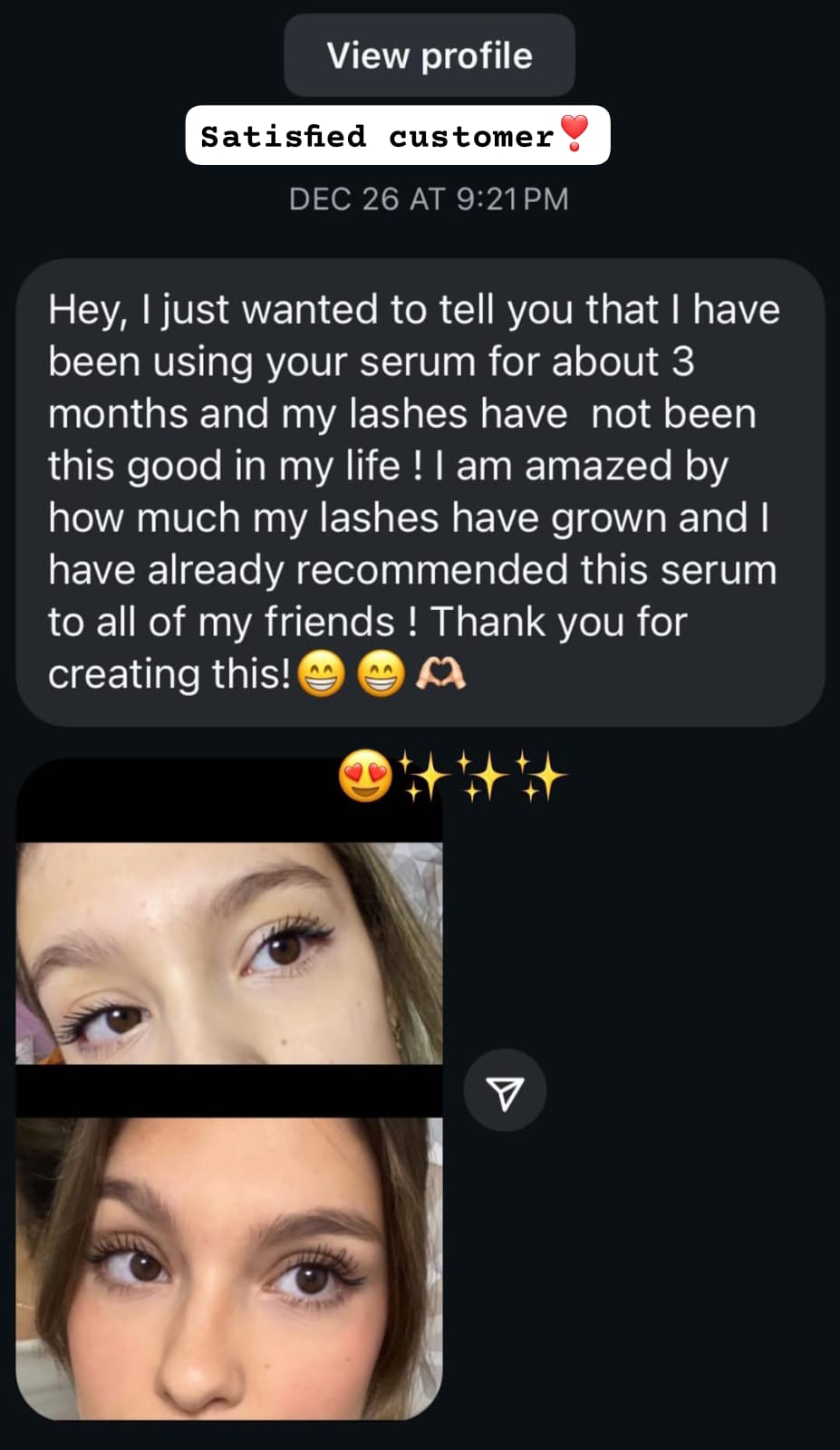 EYELASHES GROWTH SERUM (FREE EYE BROWS GROWTH SERUM)