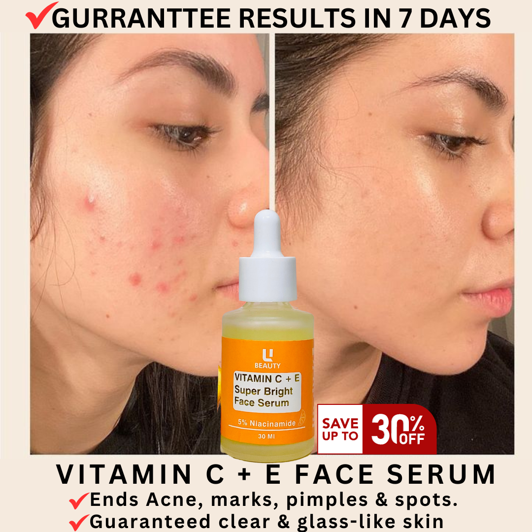 ANTI ACNE SERUM